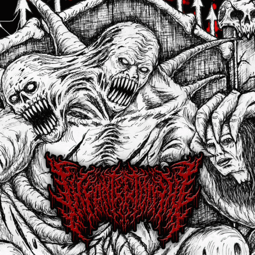 Infantectomy : Putrid Vaginal Discharge